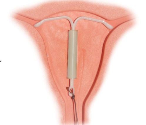 成人戴塑料环好吗视频,安全与舒适并存